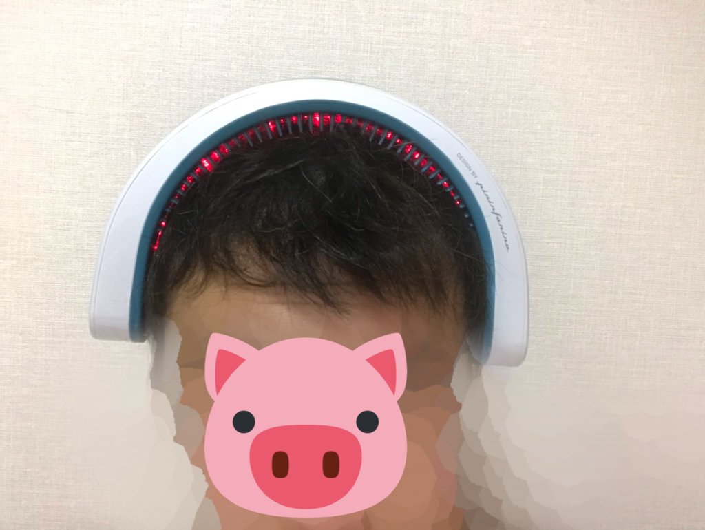 頭頂部にレザーバンド82