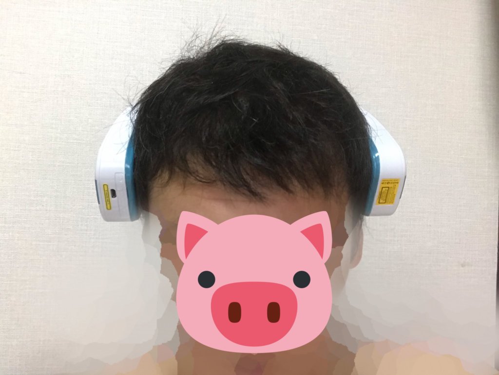 後頭部にレザーバンド82